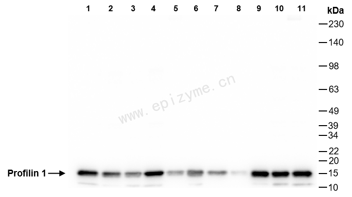 Anti-Profilin 1 Rabbit mAb [53M16M53]