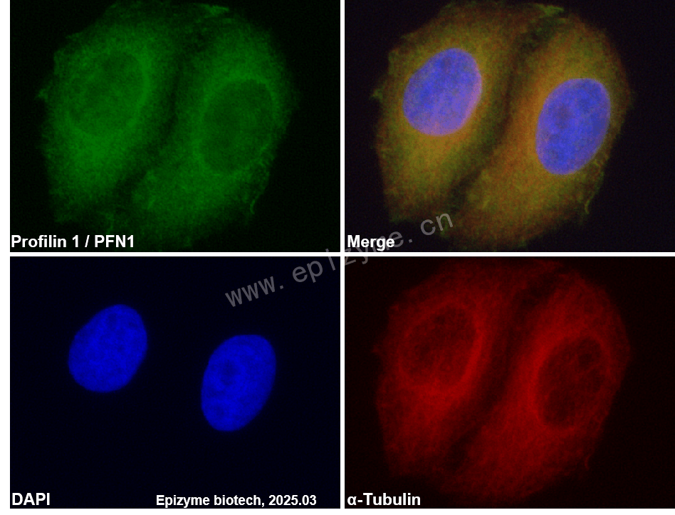 Anti-Profilin 1 Rabbit mAb [53M16M53]