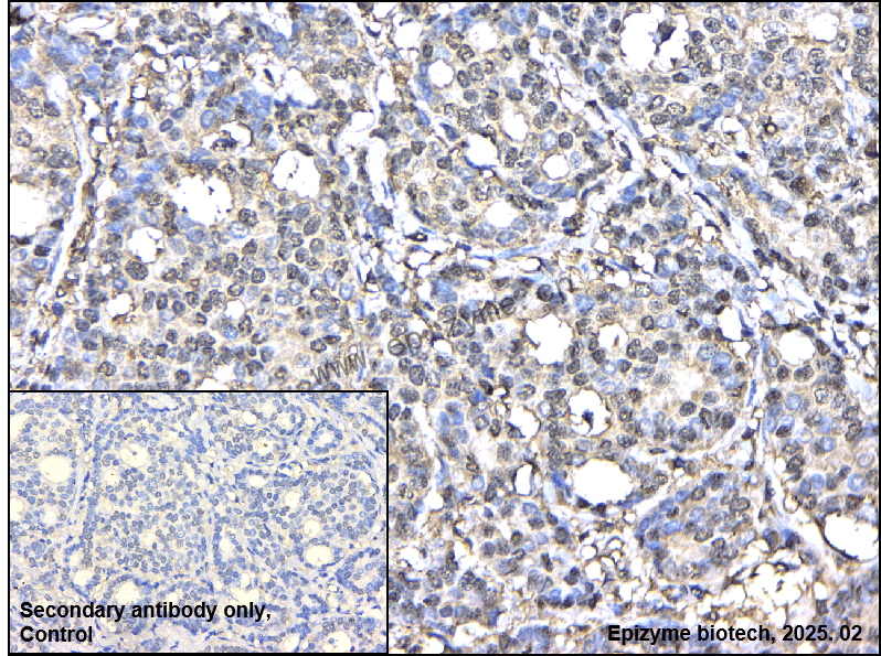 Anti-Profilin 1 Rabbit mAb [53M16M53]