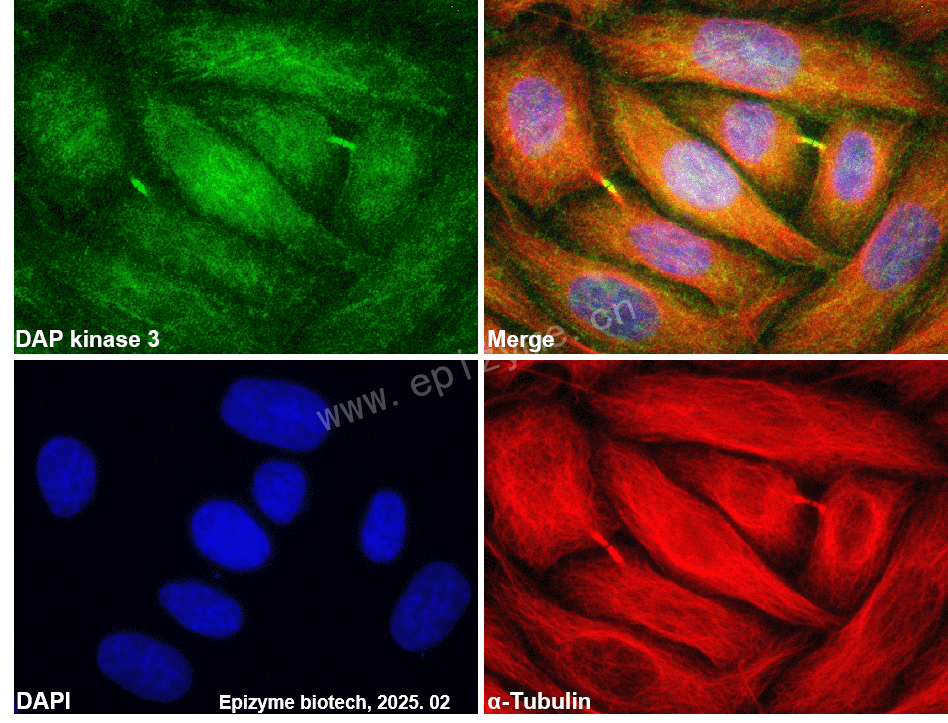 Anti-DAP kinase 3 Rabbit mAb [10L17L01]