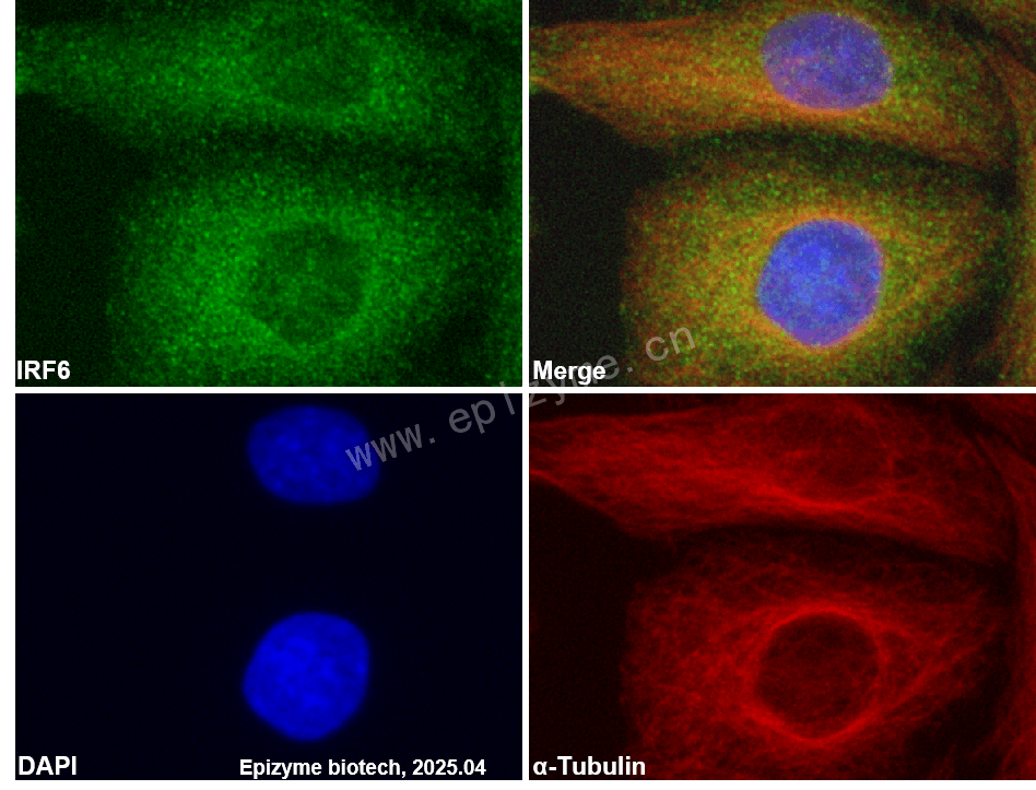 Anti-IRF6 Rabbit mAb [18K06J44]