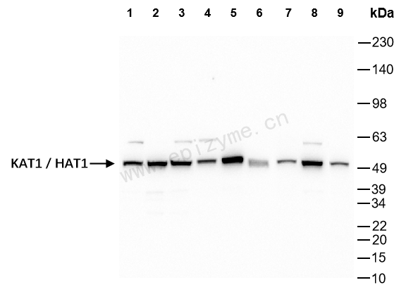 Anti-HAT1/KAT1 Rabbit mAb [79J66I74]