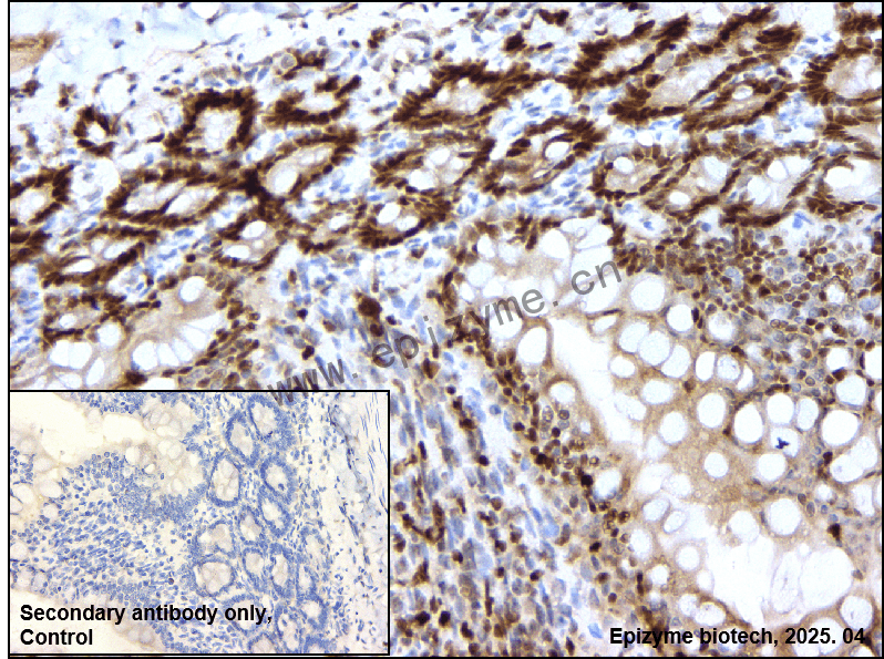 Anti-HAT1/KAT1 Rabbit mAb [79J66I74]