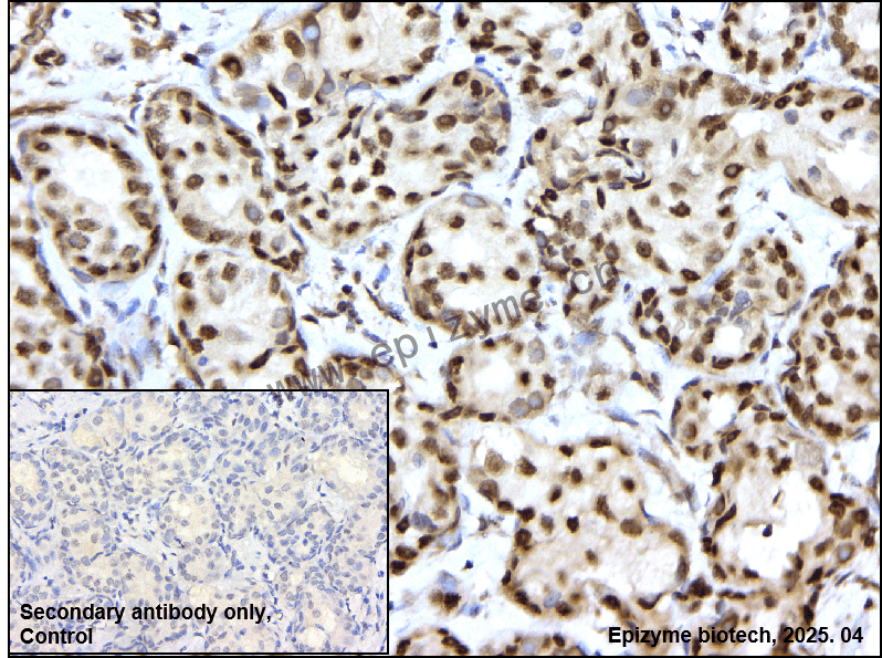 Anti-HAT1/KAT1 Rabbit mAb [79J66I74]