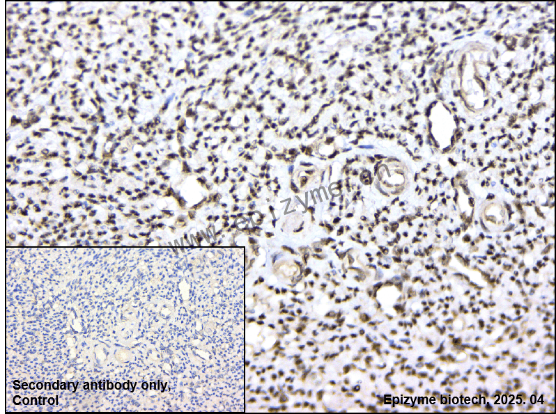 Anti-HAT1/KAT1 Rabbit mAb [79J66I74]