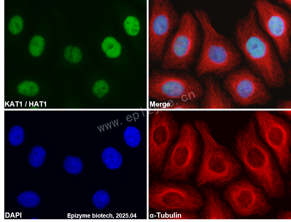 Anti-HAT1/KAT1 Rabbit mAb [79J66I74]