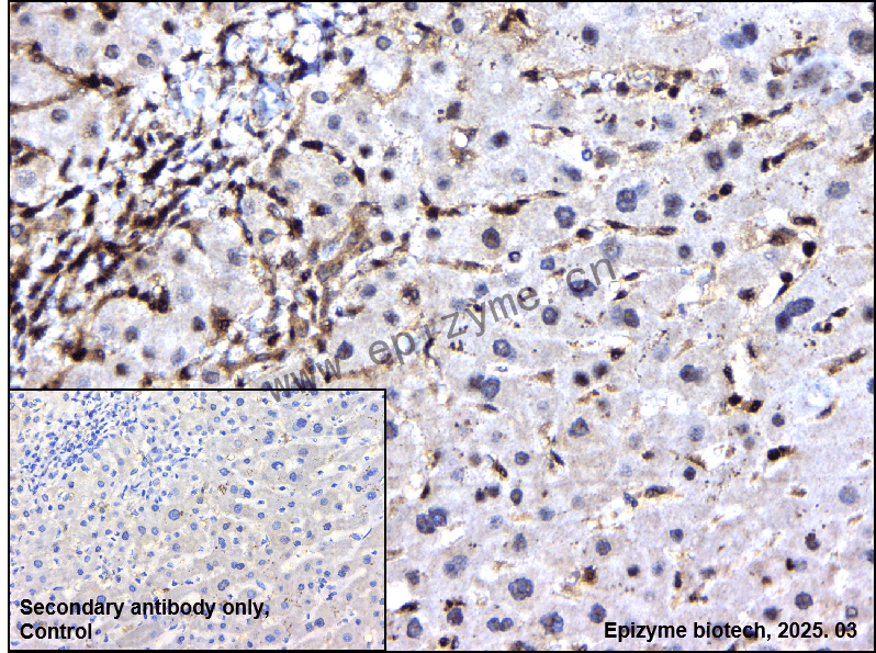 Anti-MAPKAP Kinase 2 Rabbit mAb [25B29C12]