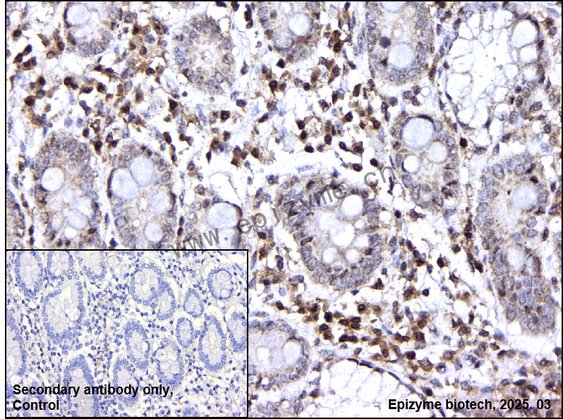 Anti-MAPKAP Kinase 2 Rabbit mAb [25B29C12]