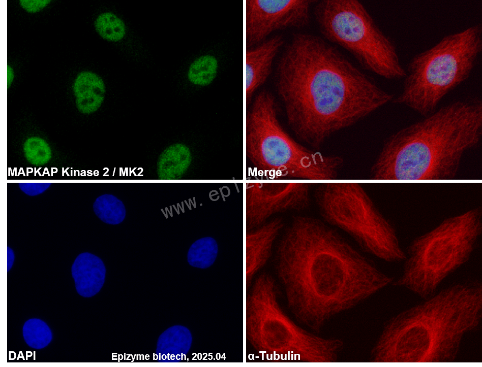 Anti-MAPKAP Kinase 2 Rabbit mAb [25B29C12]