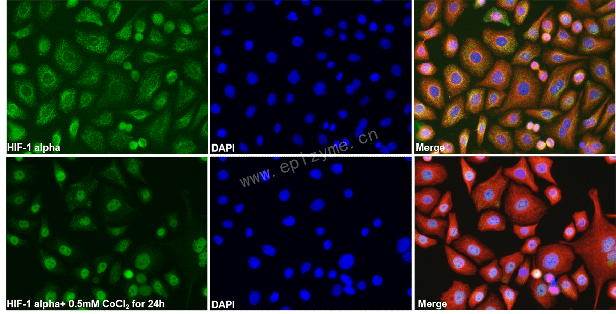 Anti-HIF-1 alpha Rabbit mAb [39H77C67]