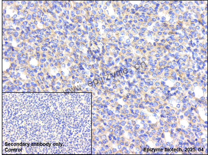 Anti-HIF-1 alpha Rabbit mAb [39H77C67]