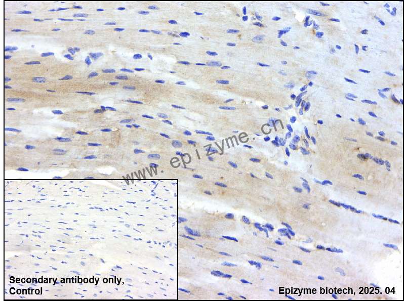 Anti-HIF-1 alpha Rabbit mAb [39H77C67]