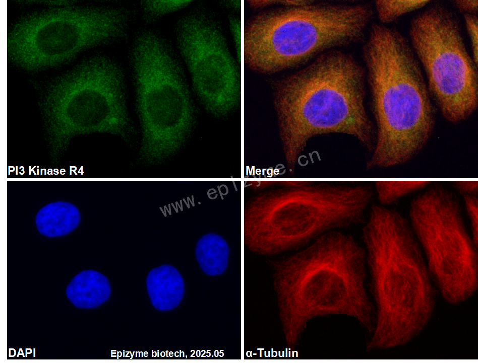Anti-VPS15 Rabbit mAb [91D98P84]