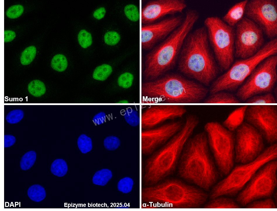 Anti-SUMO1 Rabbit mAb [41N34F85]