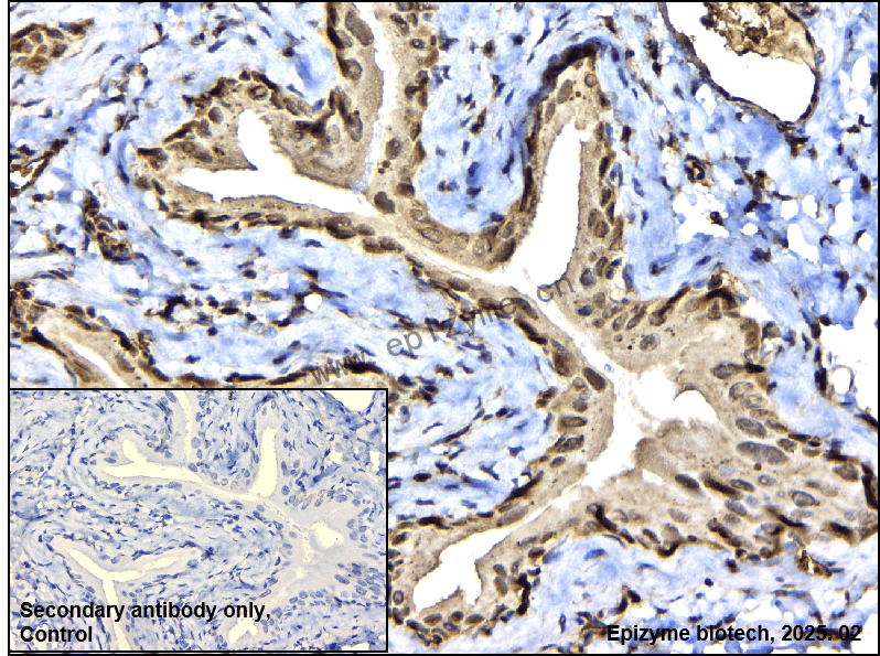 Anti-SUMO1 Rabbit mAb [41N34F85]