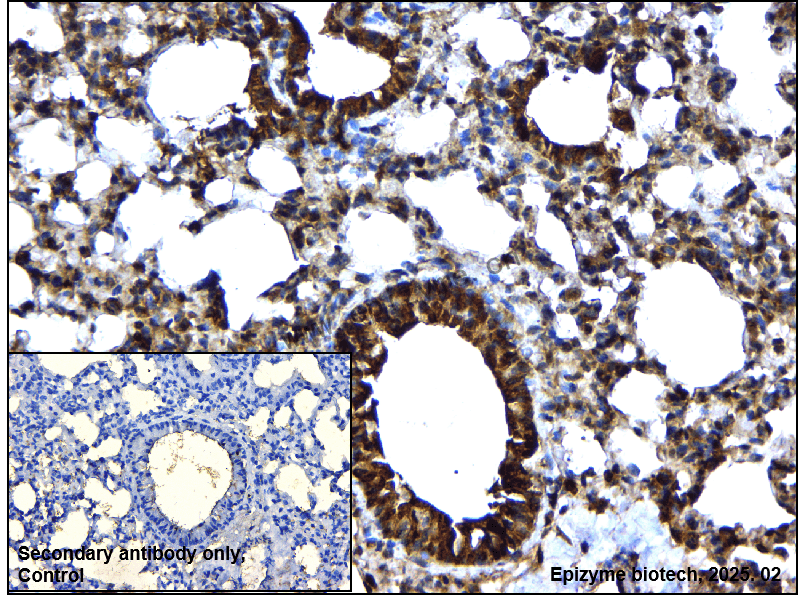 Anti-SUMO1 Rabbit mAb [41N34F85]