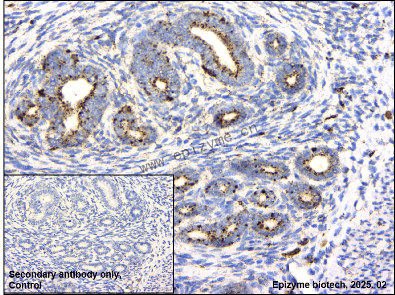 Anti-NAGLU/NAG Rabbit mAb [66I73P15]