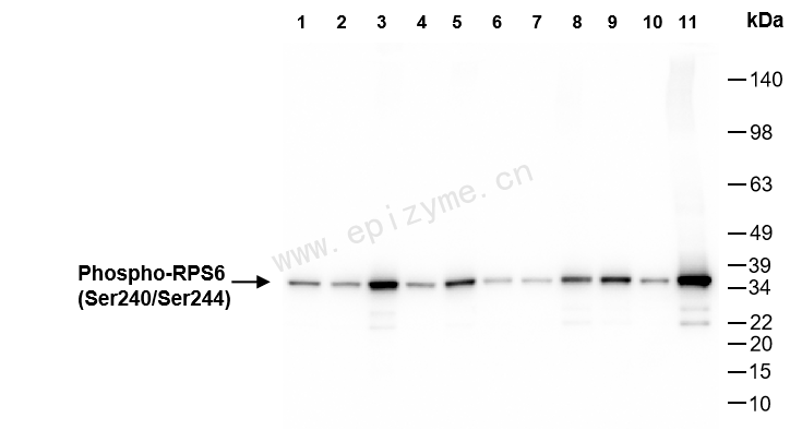 Anti-Phospho-RPS6 (Ser240/Ser244) Rabbit mAb [95D07D76]