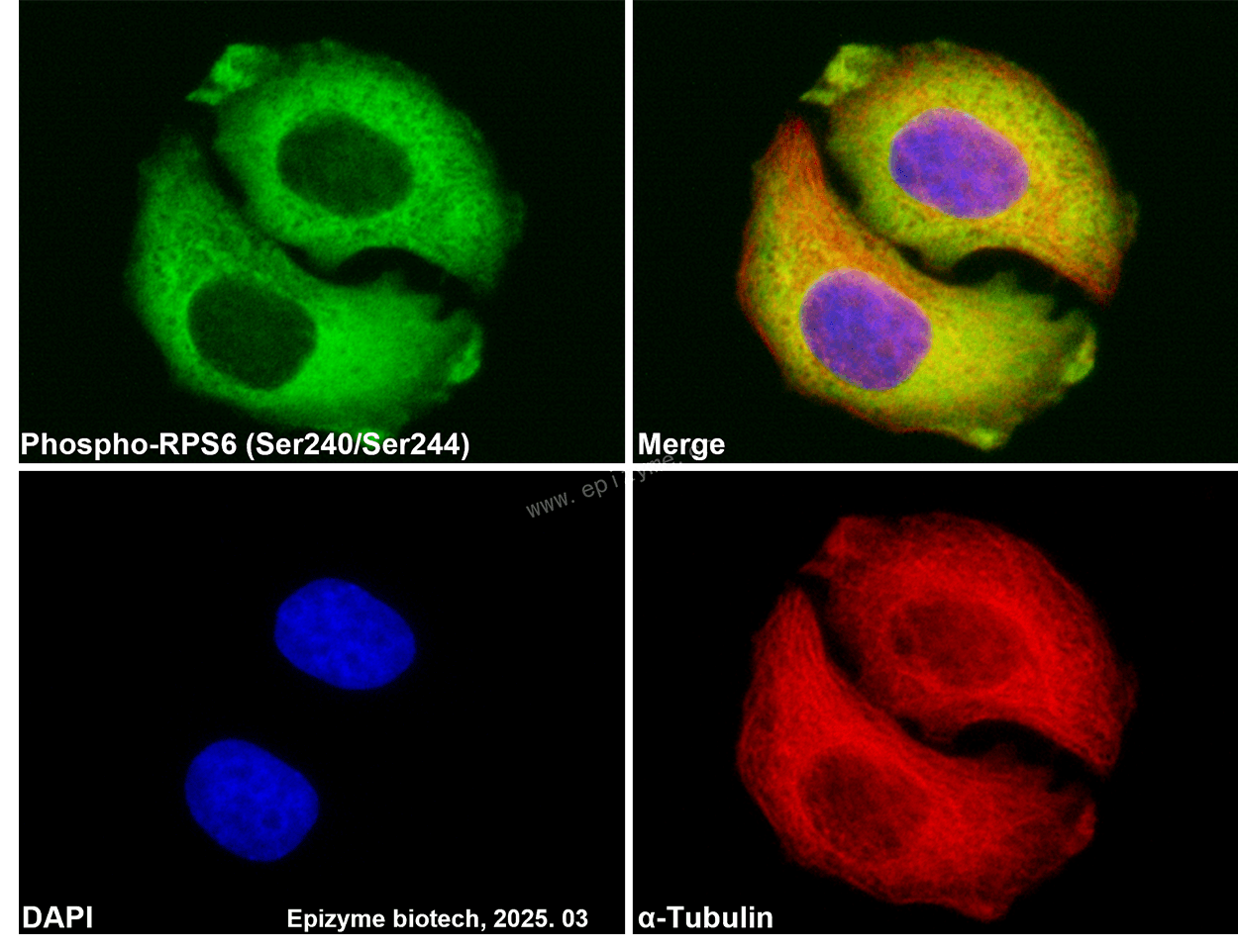 Anti-Phospho-RPS6 (Ser240/Ser244) Rabbit mAb [95D07D76]