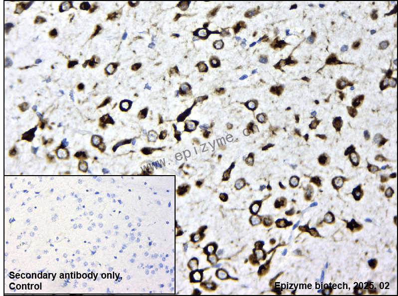 Anti-Phospho-RPS6 (Ser240/Ser244) Rabbit mAb [95D07D76]