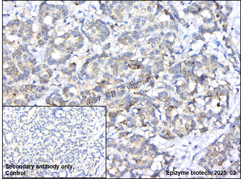 Anti-Phospho-RPS6 (Ser240/Ser244) Rabbit mAb [95D07D76]