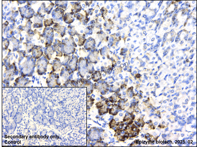Anti-Phospho-RPS6 (Ser240/Ser244) Rabbit mAb [95D07D76]
