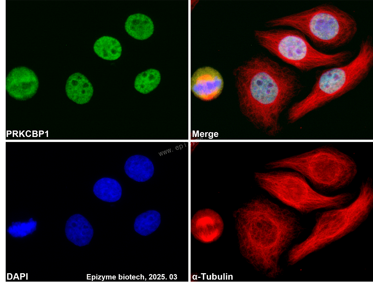 Anti-ZMYND8 Rabbit mAb [68A90C45]