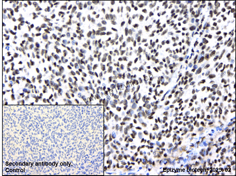 Anti-ZMYND8 Rabbit mAb [68A90C45]