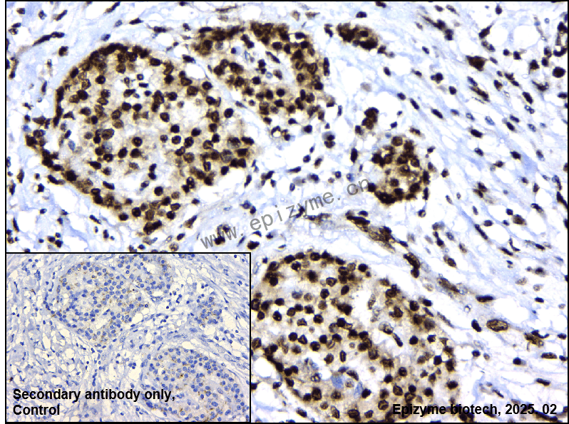 Anti-ZMYND8 Rabbit mAb [68A90C45]