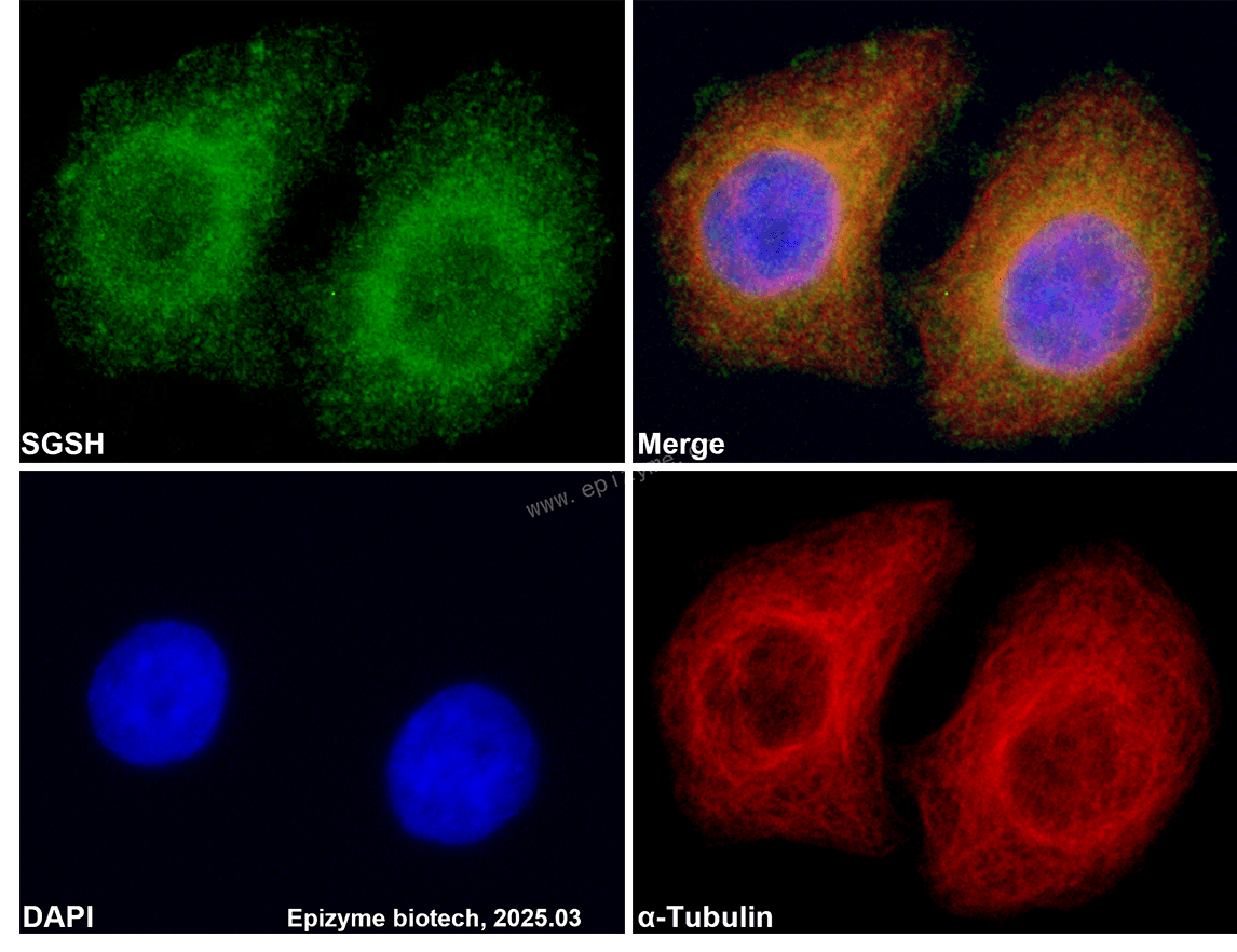 Anti-SGSH/HSS Rabbit mAb [11H37N03]