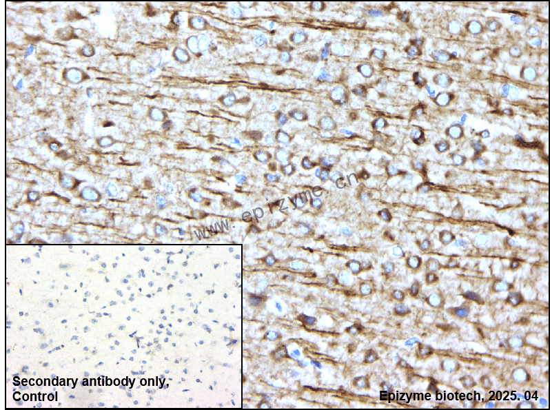 Anti-Phospho-Tau (Thr231) Rabbit mAb [10C20C82]