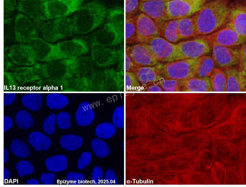 Anti-IL-13 receptor alpha 1 Rabbit mAb [23T49K80]