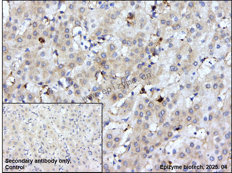 Anti-IL-13 receptor alpha 1 Rabbit mAb [23T49K80]