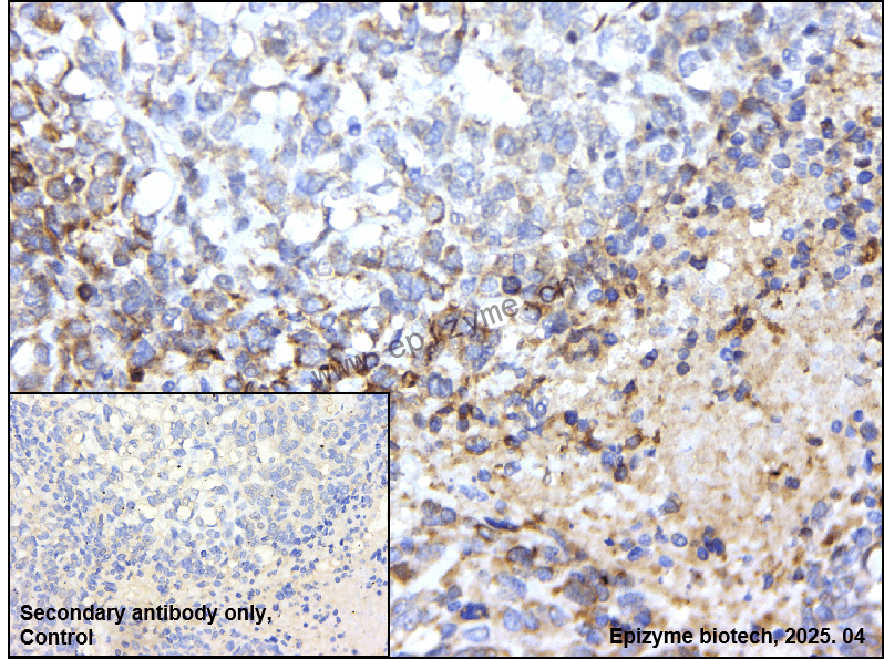 Anti-IL-13 receptor alpha 1 Rabbit mAb [23T49K80]