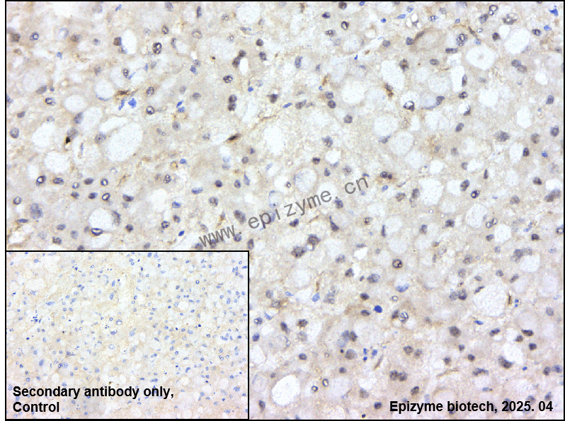 Anti-FRS2 Rabbit mAb [76M29N46]