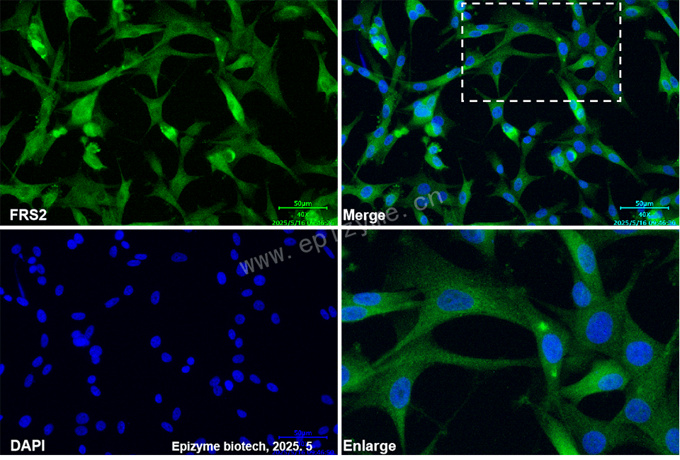 Anti-FRS2 Rabbit mAb [76M29N46]