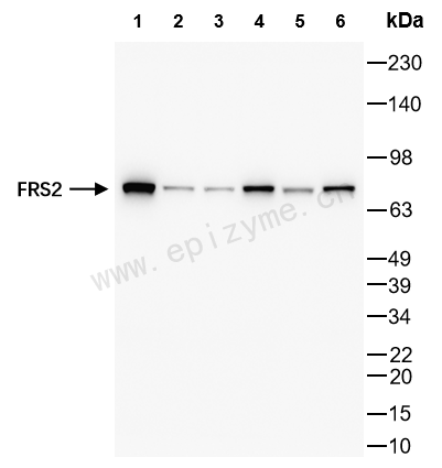 Anti-FRS2 Rabbit mAb [76M29N46]