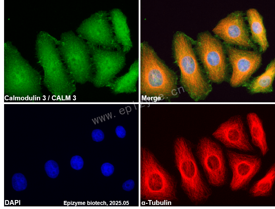 Anti-Calmodulin 3 Rabbit mAb [68P49S38]