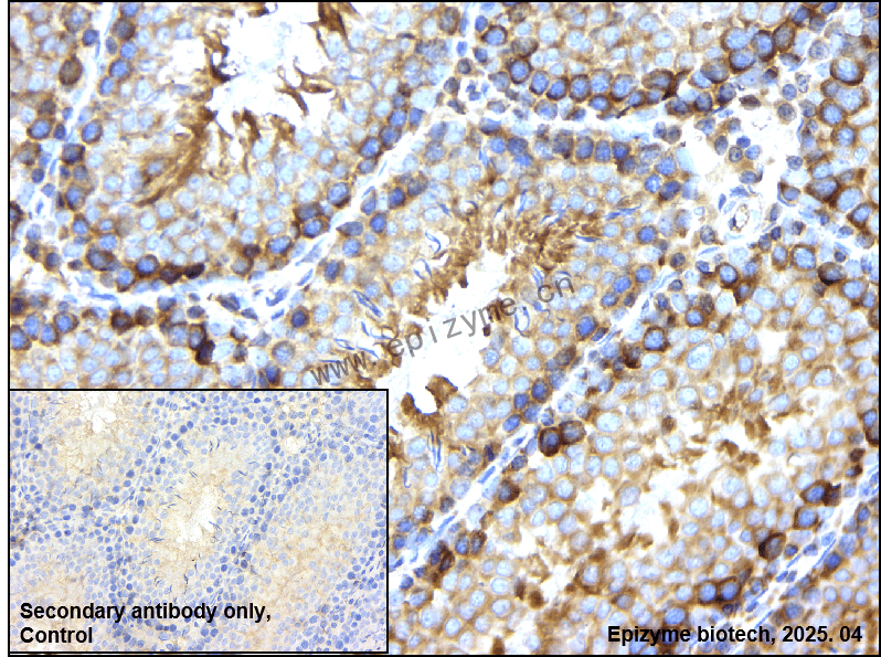 Anti-Beta Arrestin 2 Rabbit mAb [87J31E91]