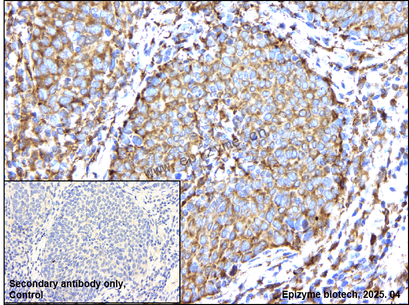 Anti-Beta Arrestin 2 Rabbit mAb [87J31E91]
