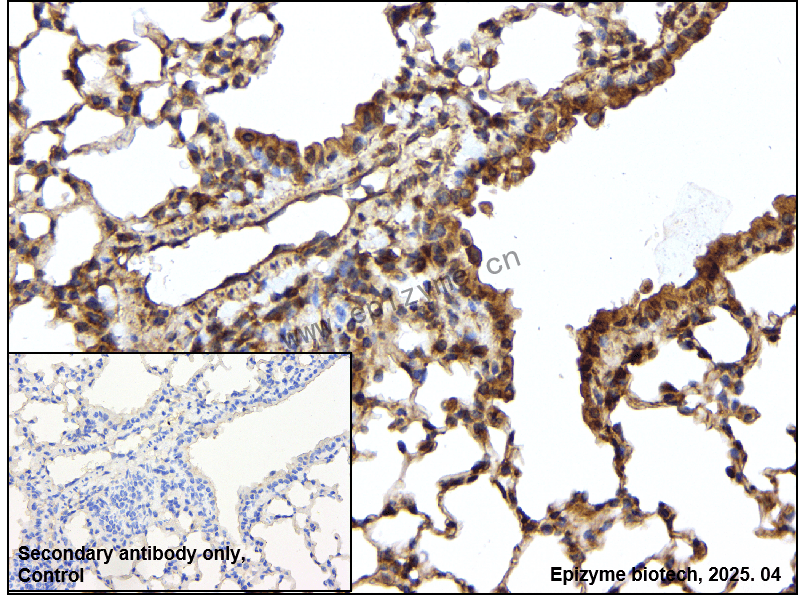 Anti-Beta Arrestin 2 Rabbit mAb [87J31E91]