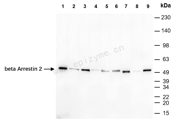 Anti-Beta Arrestin 2 Rabbit mAb [87J31E91]