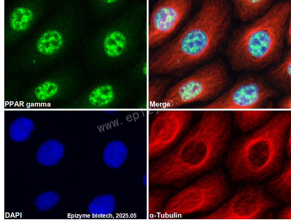 Anti-PPAR gamma Rabbit mAb [14N93N79]