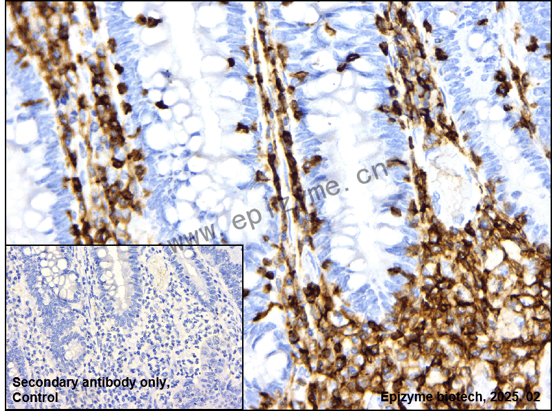 Anti-CD45 Rabbit mAb [99T56I88]