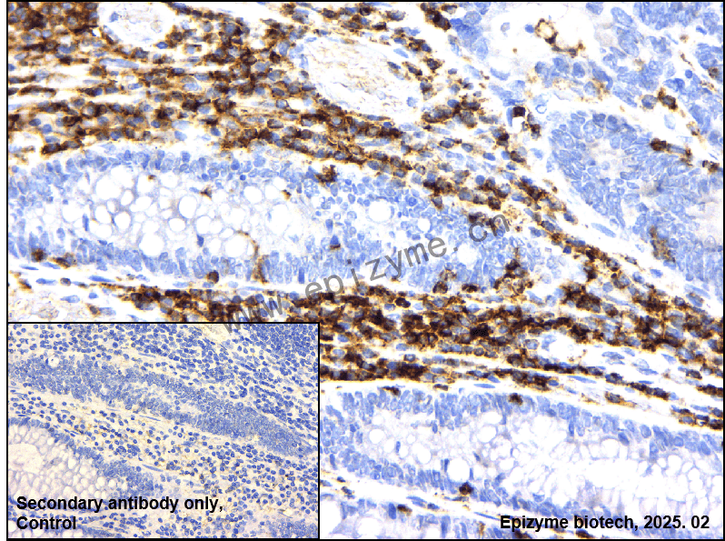 Anti-CD45 Rabbit mAb [99T56I88]