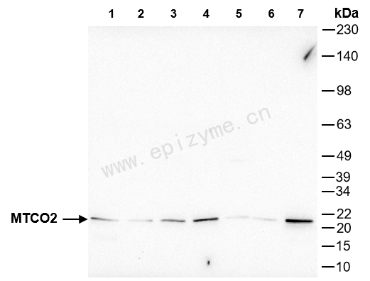 Anti-MTCO2 Rabbit mAb [71Q50D00]