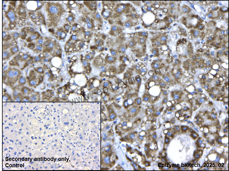 Anti-MTCO2 Rabbit mAb [71Q50D00]
