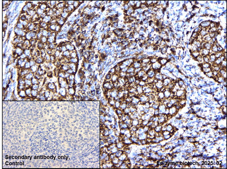 Anti-MTCO2 Rabbit mAb [71Q50D00]