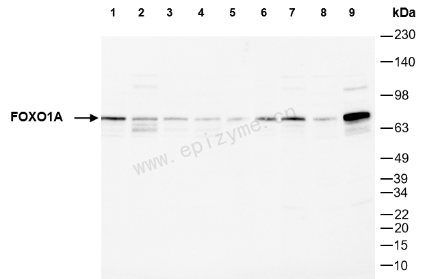 Anti-FOXO1 Rabbit mAb [91C34J78]