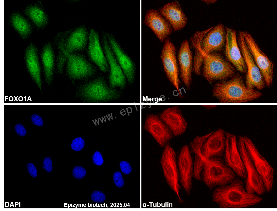 Anti-FOXO1 Rabbit mAb [91C34J78]